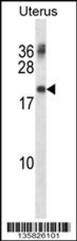 Western blot analysis in human normal Uterus tissue lysates (35ug/lane).