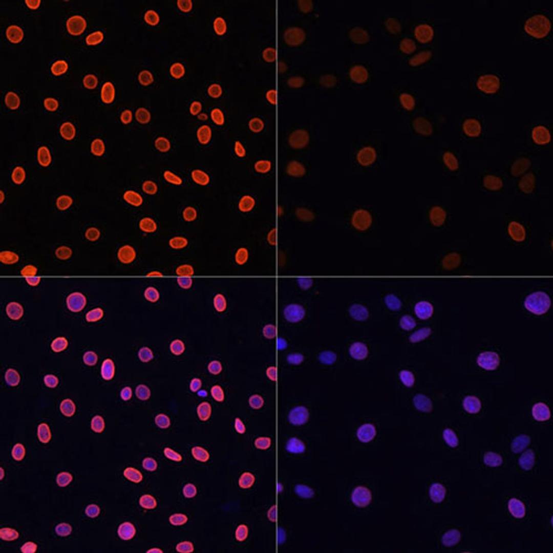 Immunofluorescence - Acetyl-Histone H4-K91 antibody (A7409)