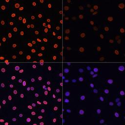 Immunofluorescence - Acetyl-Histone H4-K91 antibody (A7409)