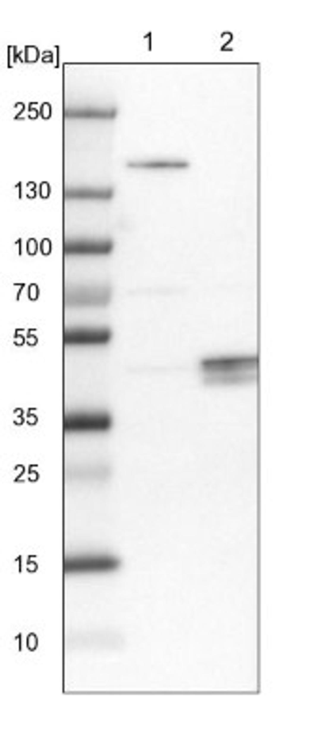 Western Blot: TTBK1 Antibody [NBP1-82888] - Lane 1: NIH-3T3 cell lysate (Mouse embryonic fibroblast cells)<br/>Lane 2: NBT-II cell lysate (Rat Wistar bladder tumour cells)