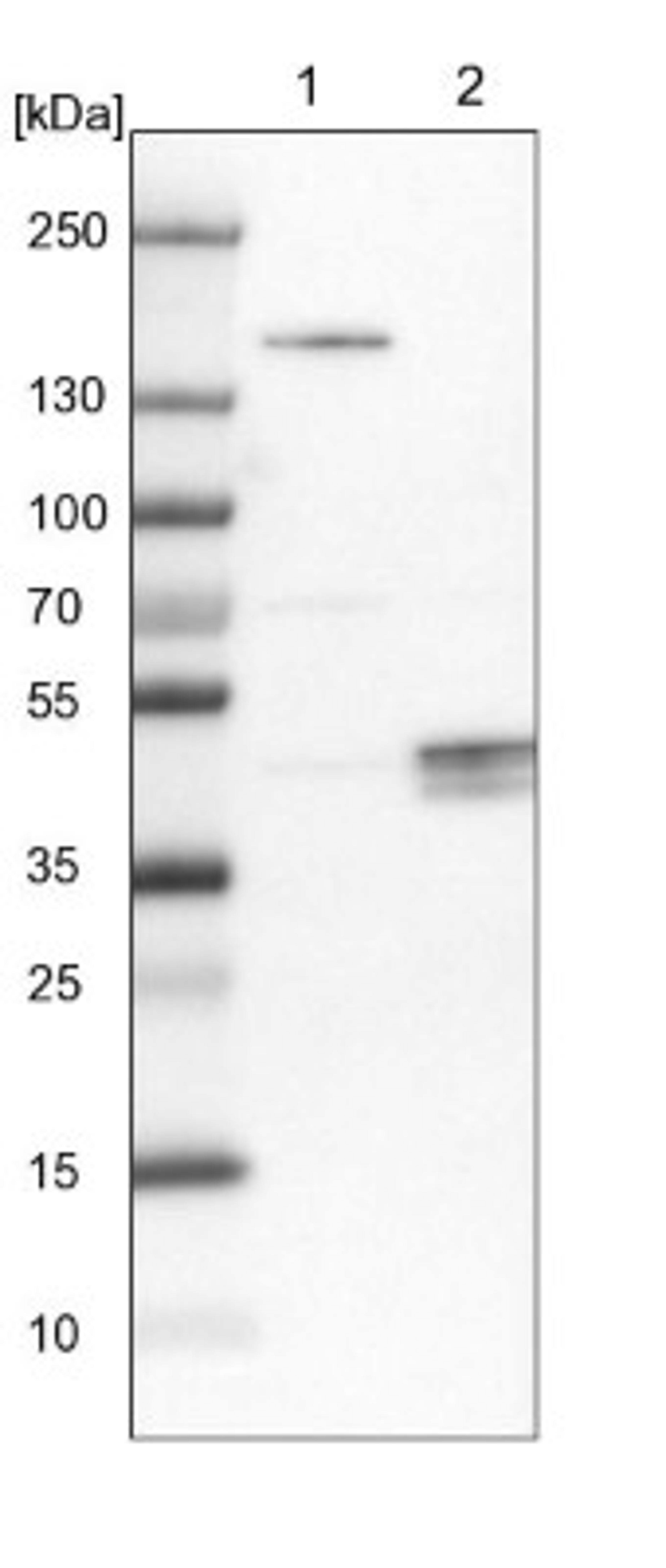 Western Blot: TTBK1 Antibody [NBP1-82888] - Lane 1: NIH-3T3 cell lysate (Mouse embryonic fibroblast cells)<br/>Lane 2: NBT-II cell lysate (Rat Wistar bladder tumour cells)