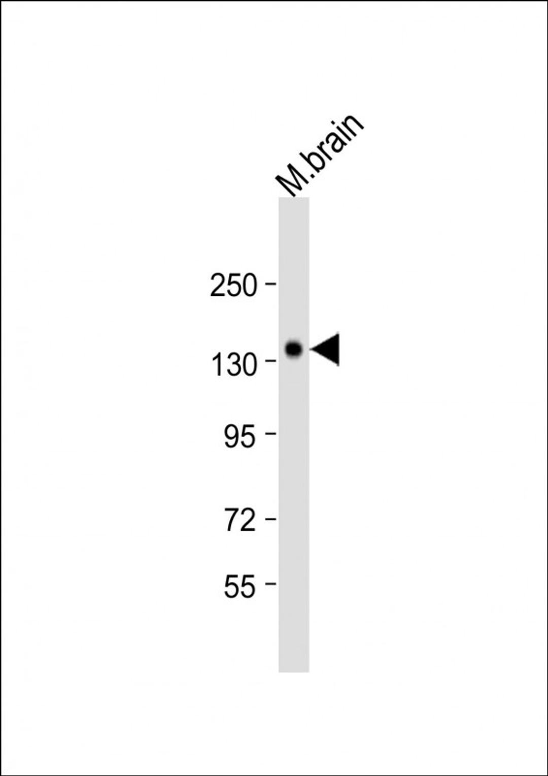 Western Blot at 1:2000 dilution + mouse brain lysate Lysates/proteins at 20 ug per lane.