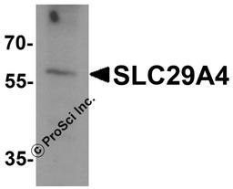 Western blot analysis of SLC29A4 in SK-N-SH cell lysate with SLC29A4 antibody at 1 μg/ml.