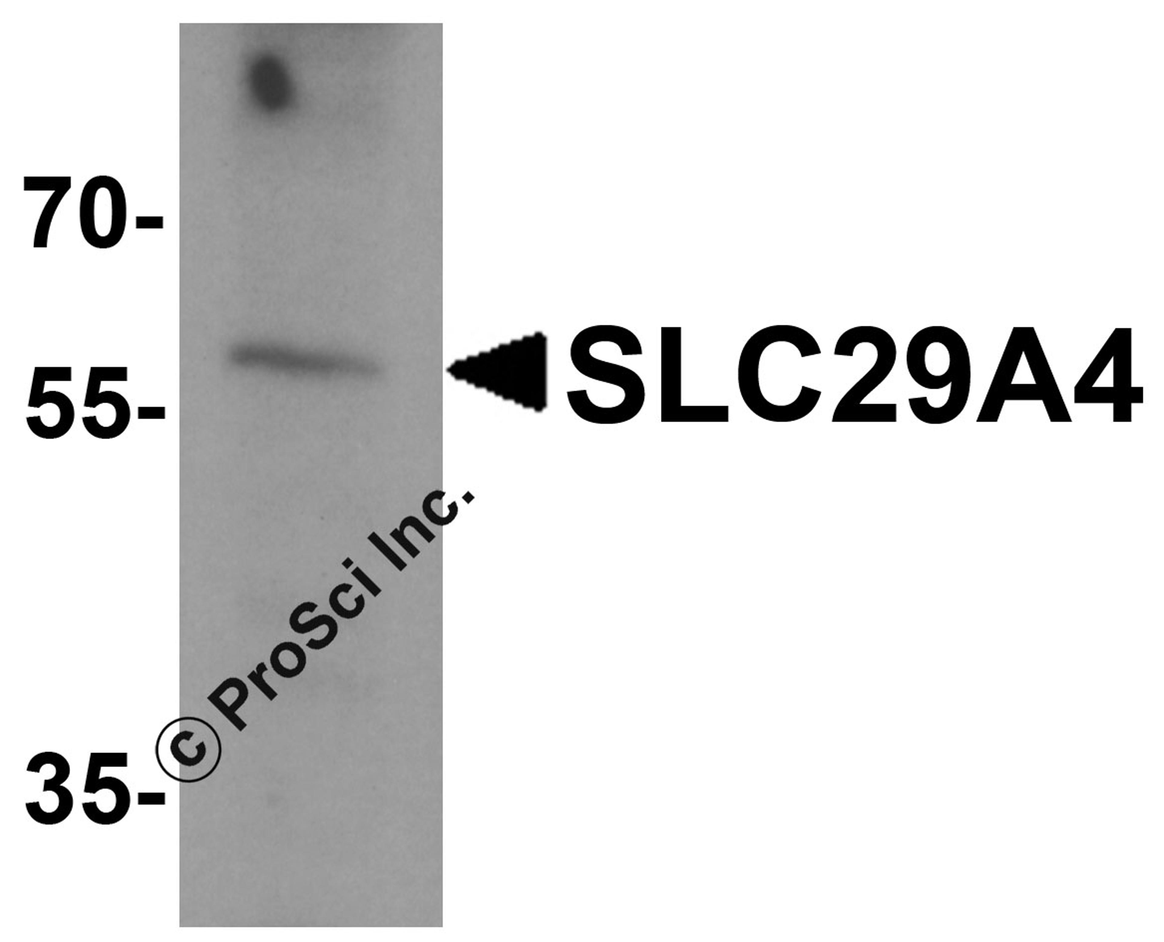 Western blot analysis of SLC29A4 in SK-N-SH cell lysate with SLC29A4 antibody at 1 μg/ml.