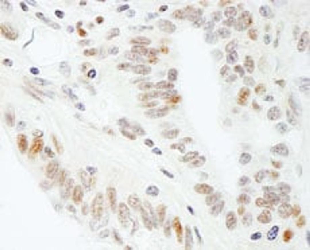 Detection of human SUPT5H by immunohistochemistry.