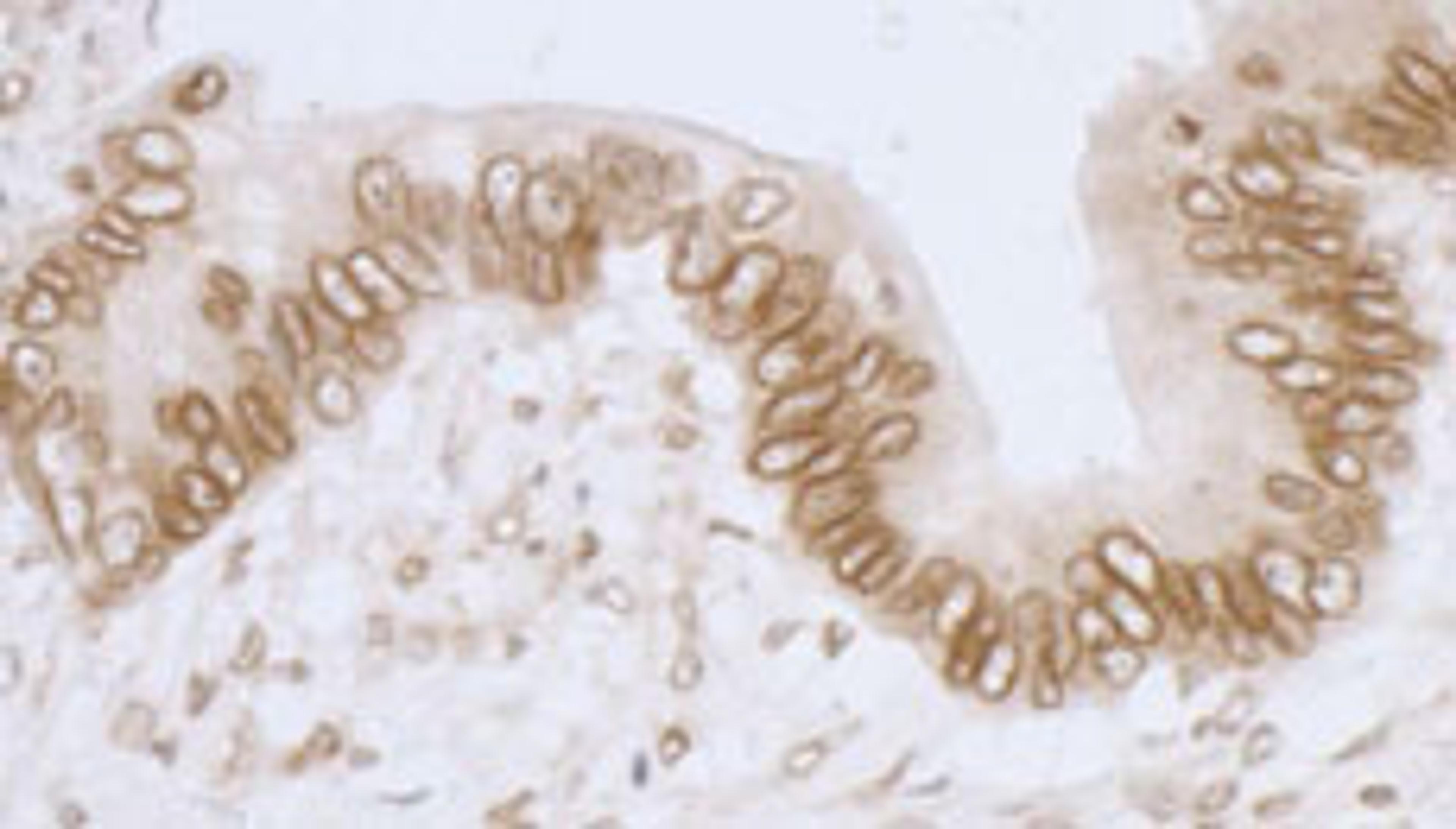 Detection of human LAP2 beta gamma /TMPO by immunohistochemistry.