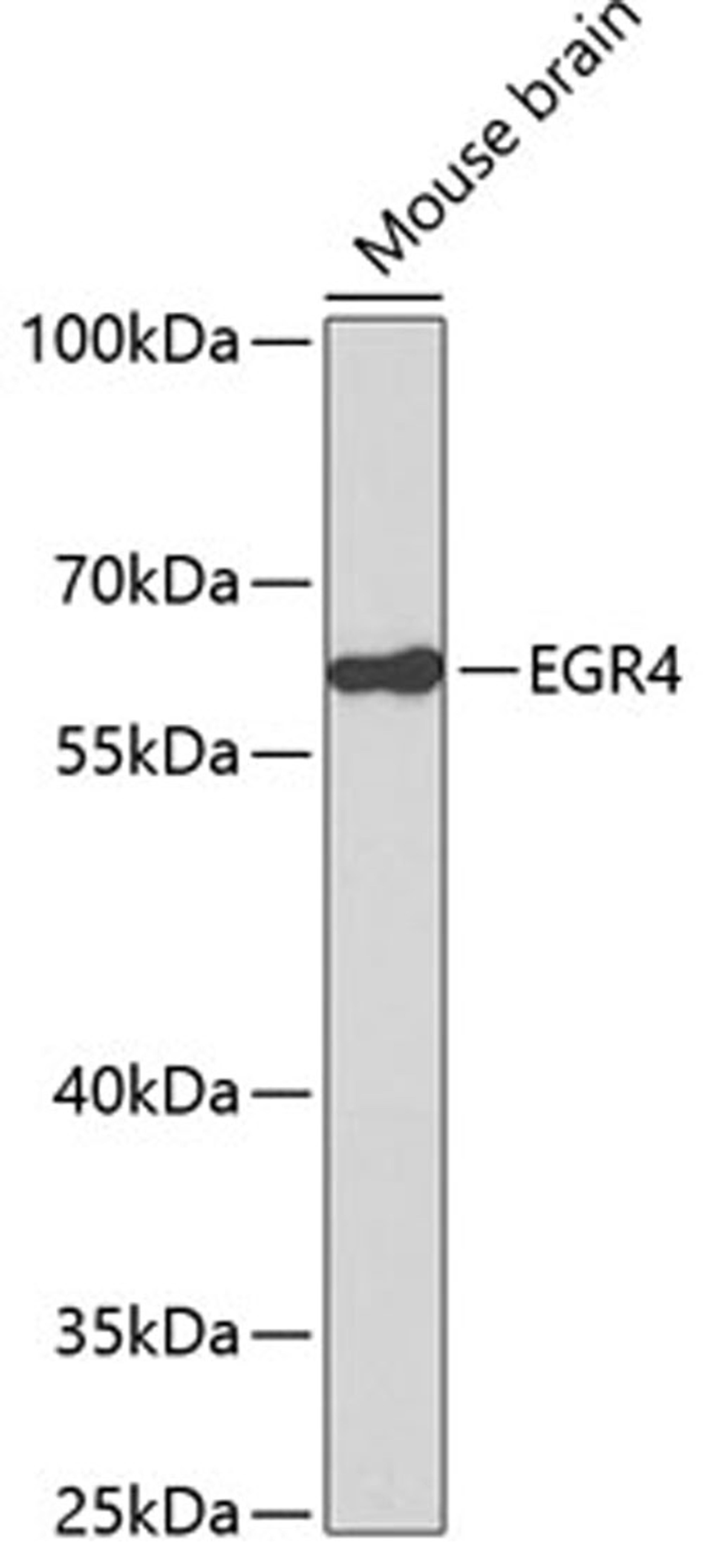 Western blot - EGR4 antibody (A2910)