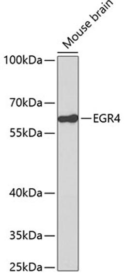 Western blot - EGR4 antibody (A2910)