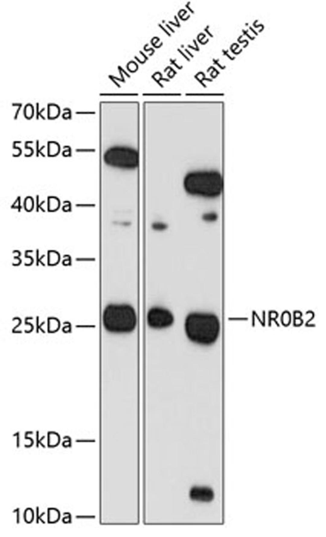 Western blot - NR0B2 antibody (A1836)