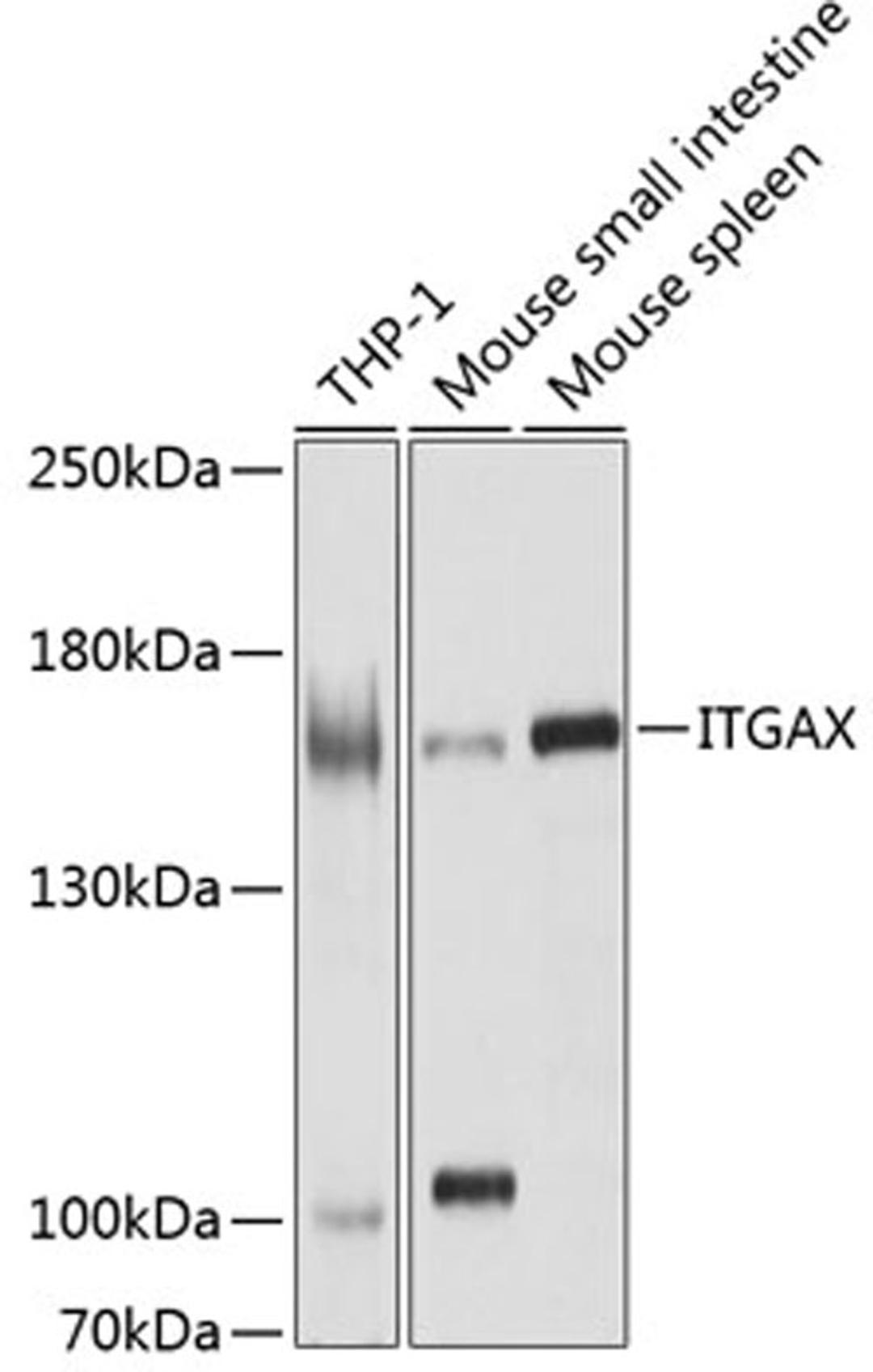 Western blot - ITGAX antibody (A1508)