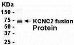 E coli-derived fusion protein as test antigen. Affinity-purified IgY dilution: 1:2000, Goat anti-IgY-HRP dilution: 1:1000. Colorimetric method for signal development.