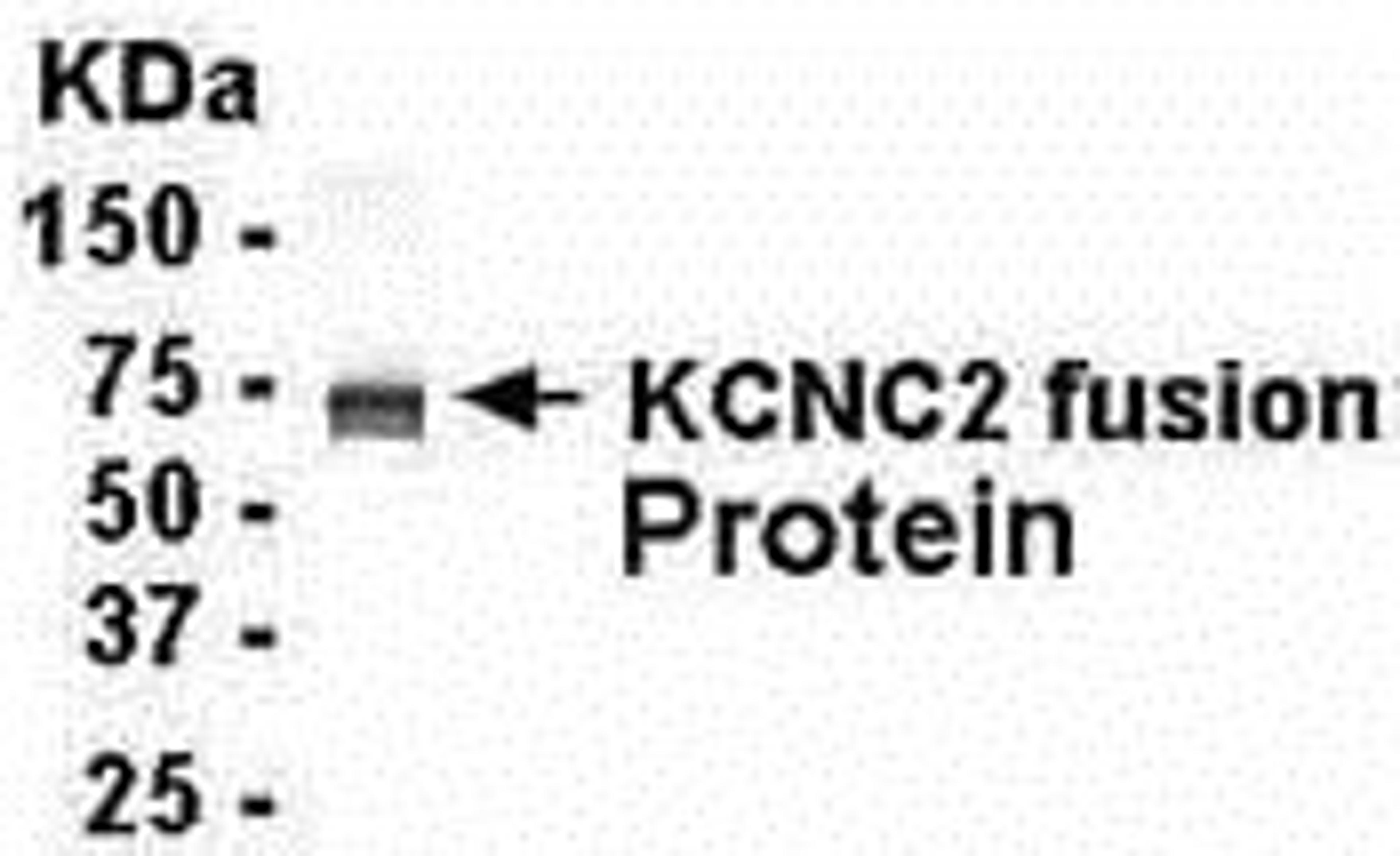 E coli-derived fusion protein as test antigen. Affinity-purified IgY dilution: 1:2000, Goat anti-IgY-HRP dilution: 1:1000. Colorimetric method for signal development.