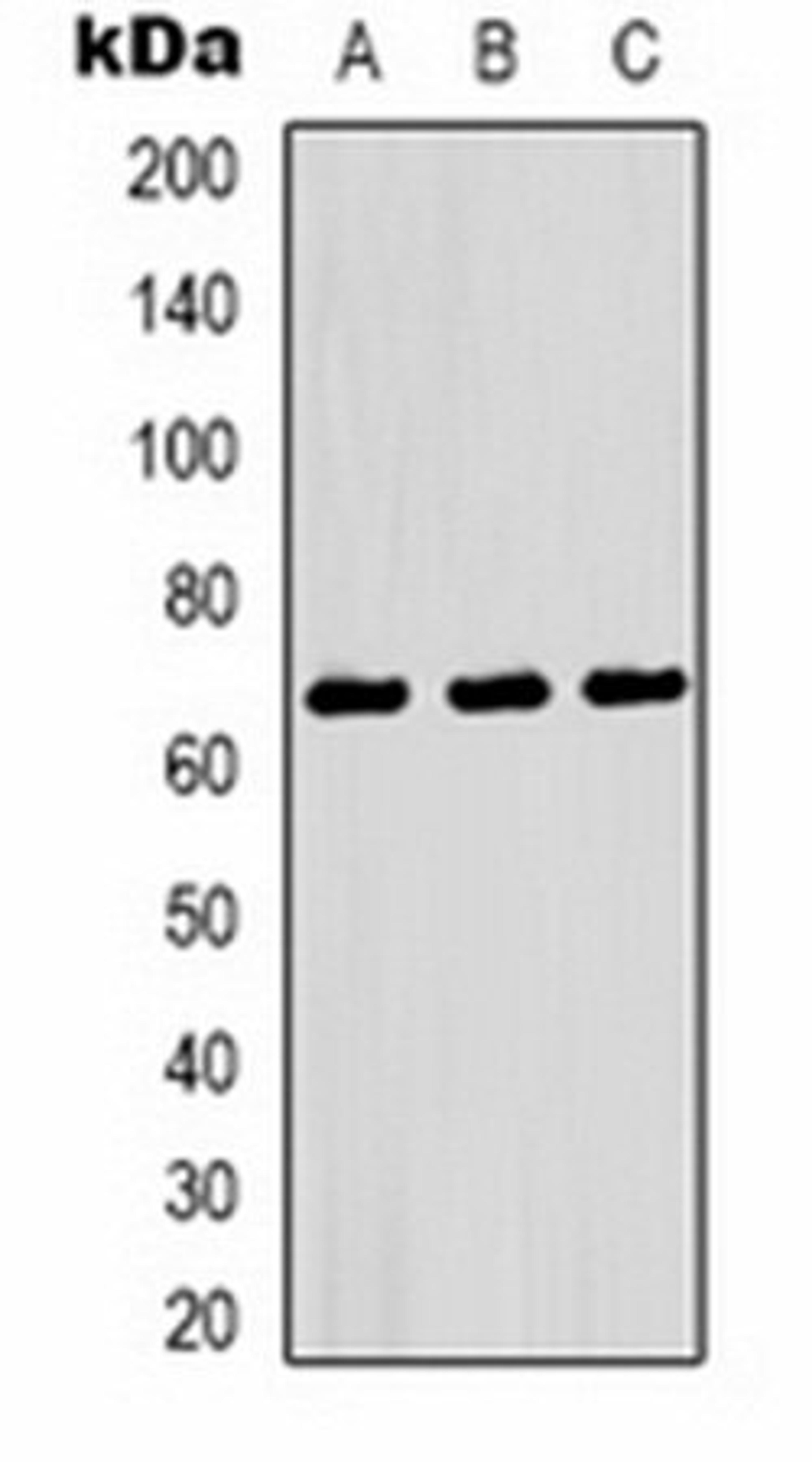 Western blot analysis of Hela (Lane 1), mouse spleen (Lane 2), rat heart (Lane 3) whole cell lysates using NF-kappaB p65 antibody