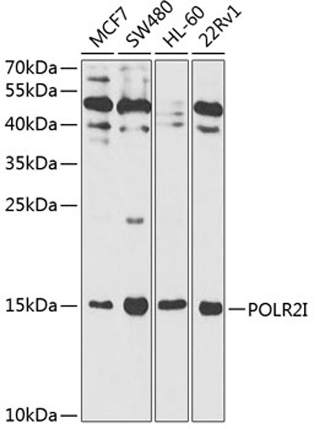 Western blot - POLR2I antibody (A1865)