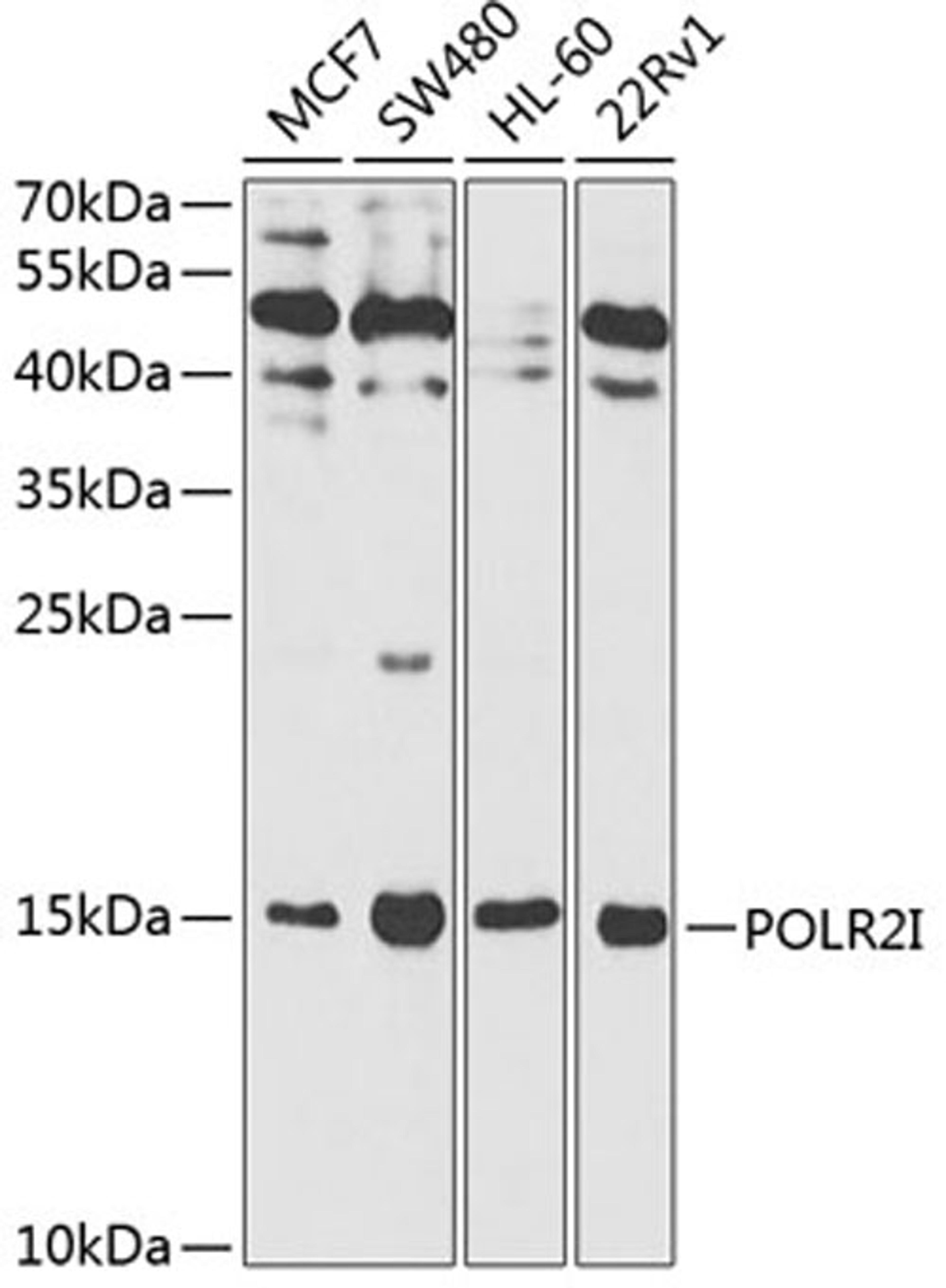 Western blot - POLR2I antibody (A1865)