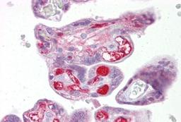 Immunohistochemistry-Paraffin: SLC26A4 Antibody [NBP1-60106] - Human placenta tissue at an antibody concentration of 5ug/ml.