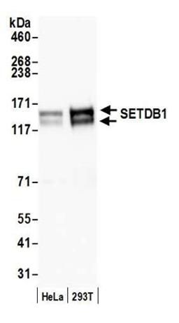 Detection of human SETDB1 by western blot.