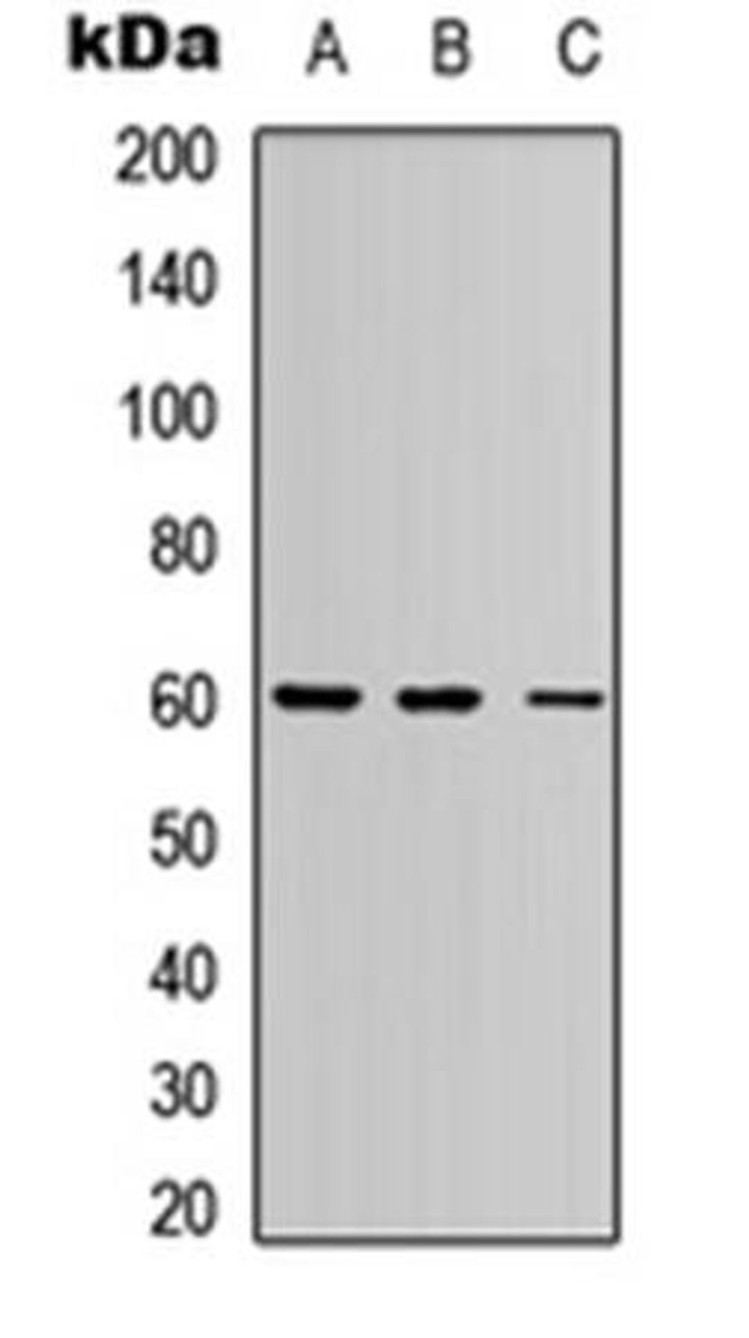 Western blot analysis of HEK293T (Lane1), Raw264.7 (Lane2), PC12 (Lane3) whole cell using PE2 antibody