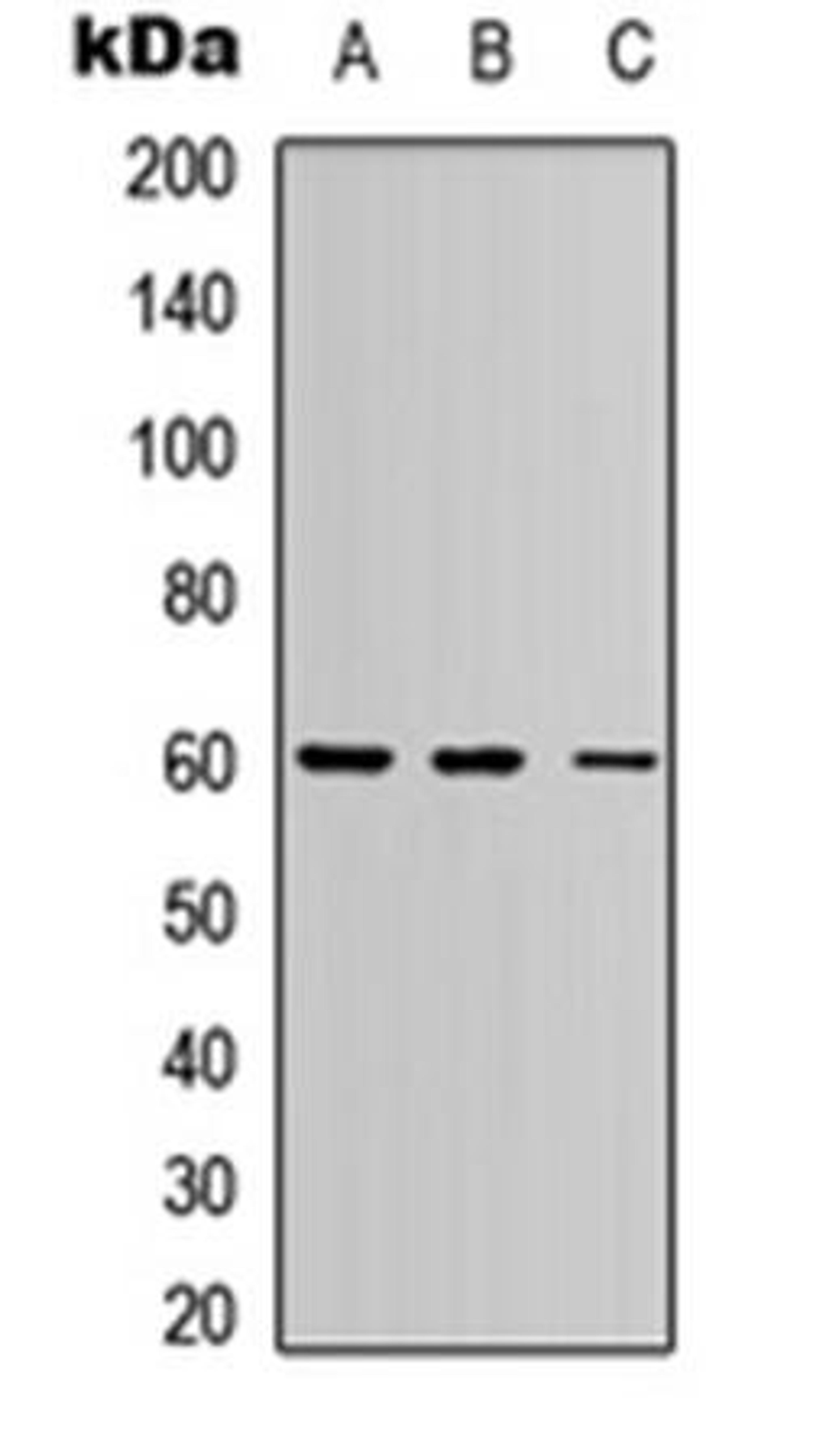 Western blot analysis of HEK293T (Lane1), Raw264.7 (Lane2), PC12 (Lane3) whole cell using PE2 antibody