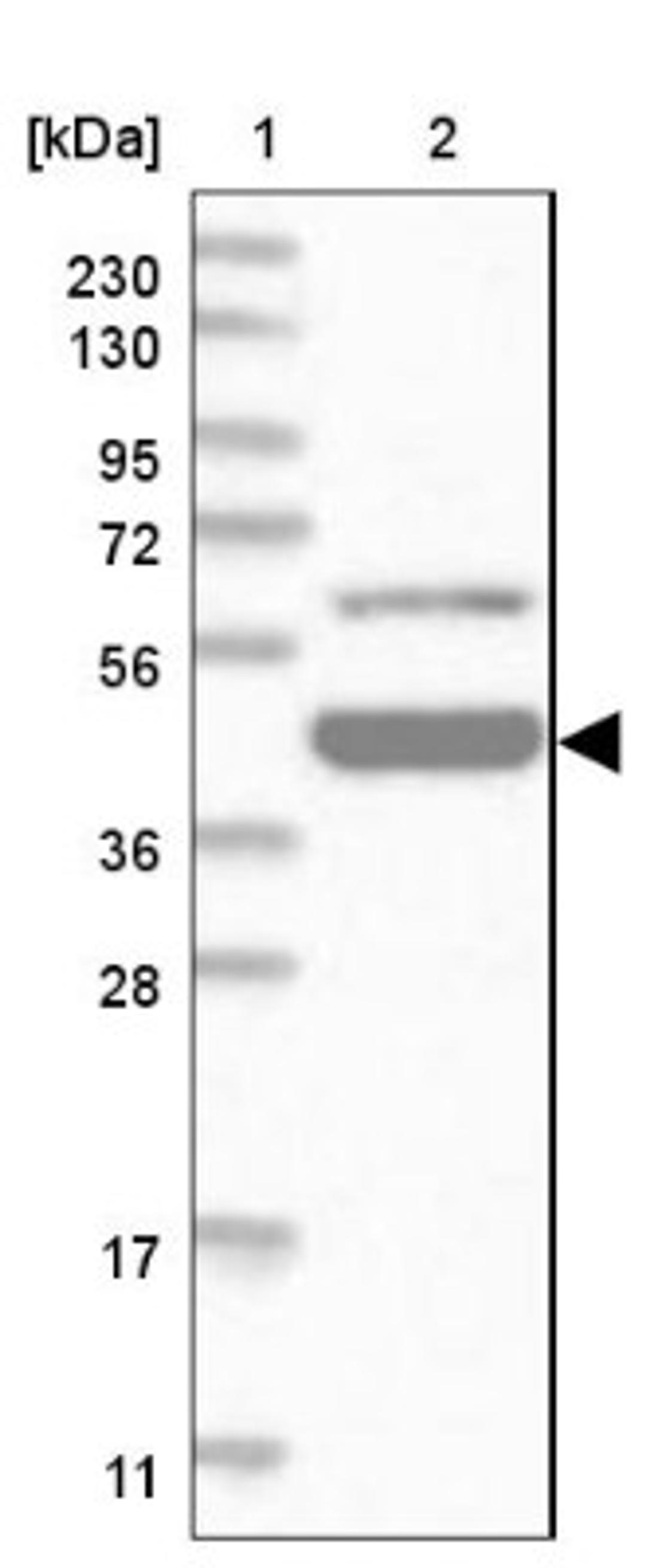 Western Blot: Zinc finger and BTB domain-containing protein 9 Antibody [NBP1-92611] - Lane 1: Marker [kDa] 230, 130, 95, 72, 56, 36, 28, 17, 11<br/>Lane 2: Human cell line RT-4