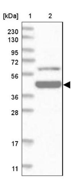 Western Blot: Zinc finger and BTB domain-containing protein 9 Antibody [NBP1-92611] - Lane 1: Marker [kDa] 230, 130, 95, 72, 56, 36, 28, 17, 11<br/>Lane 2: Human cell line RT-4