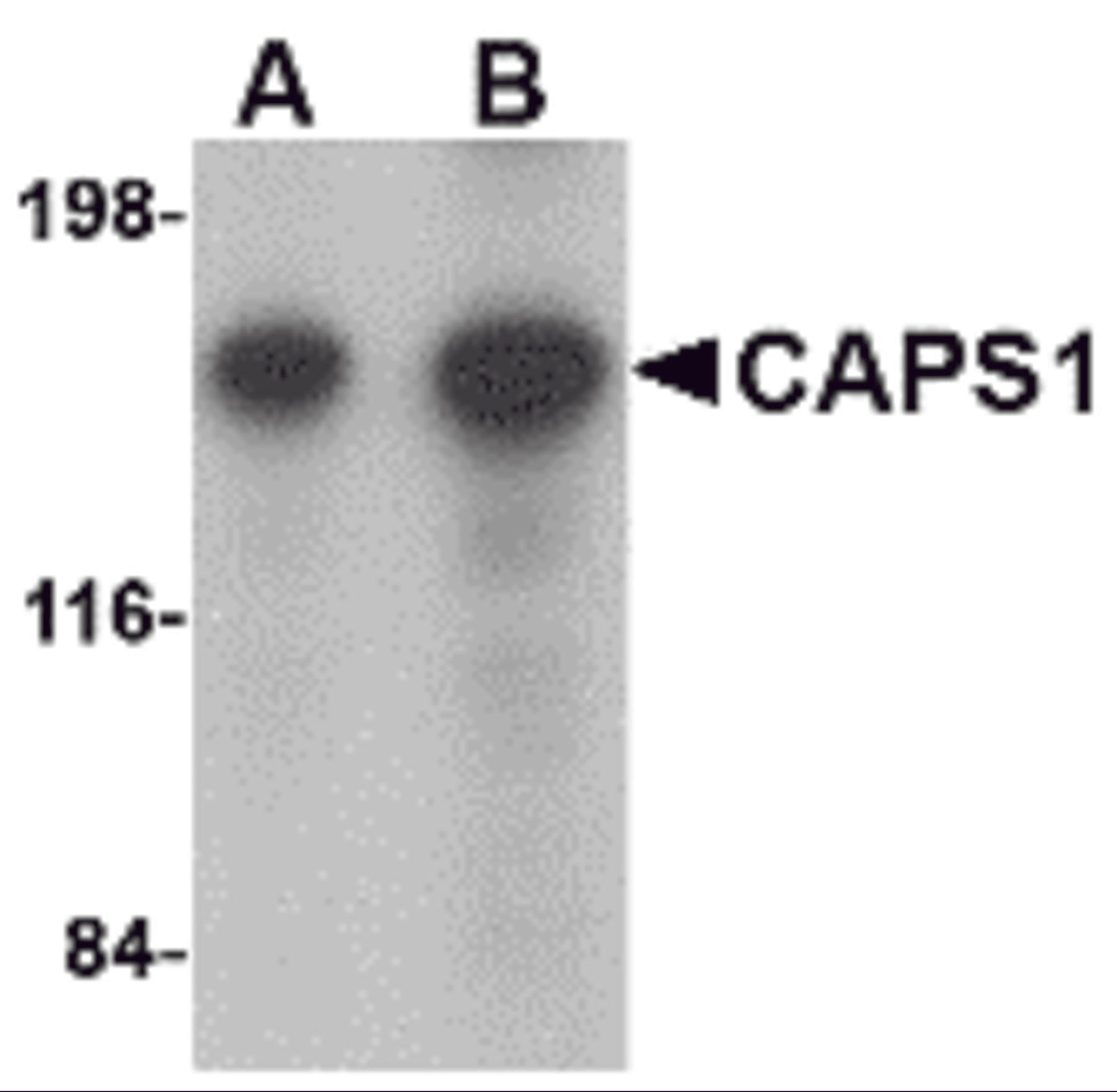 Western blot analysis of CAPS1 in rat brain tissue lysate with CAPS1 antibody at (A) 0.25 and (B) 0.5 &#956;g/mL.