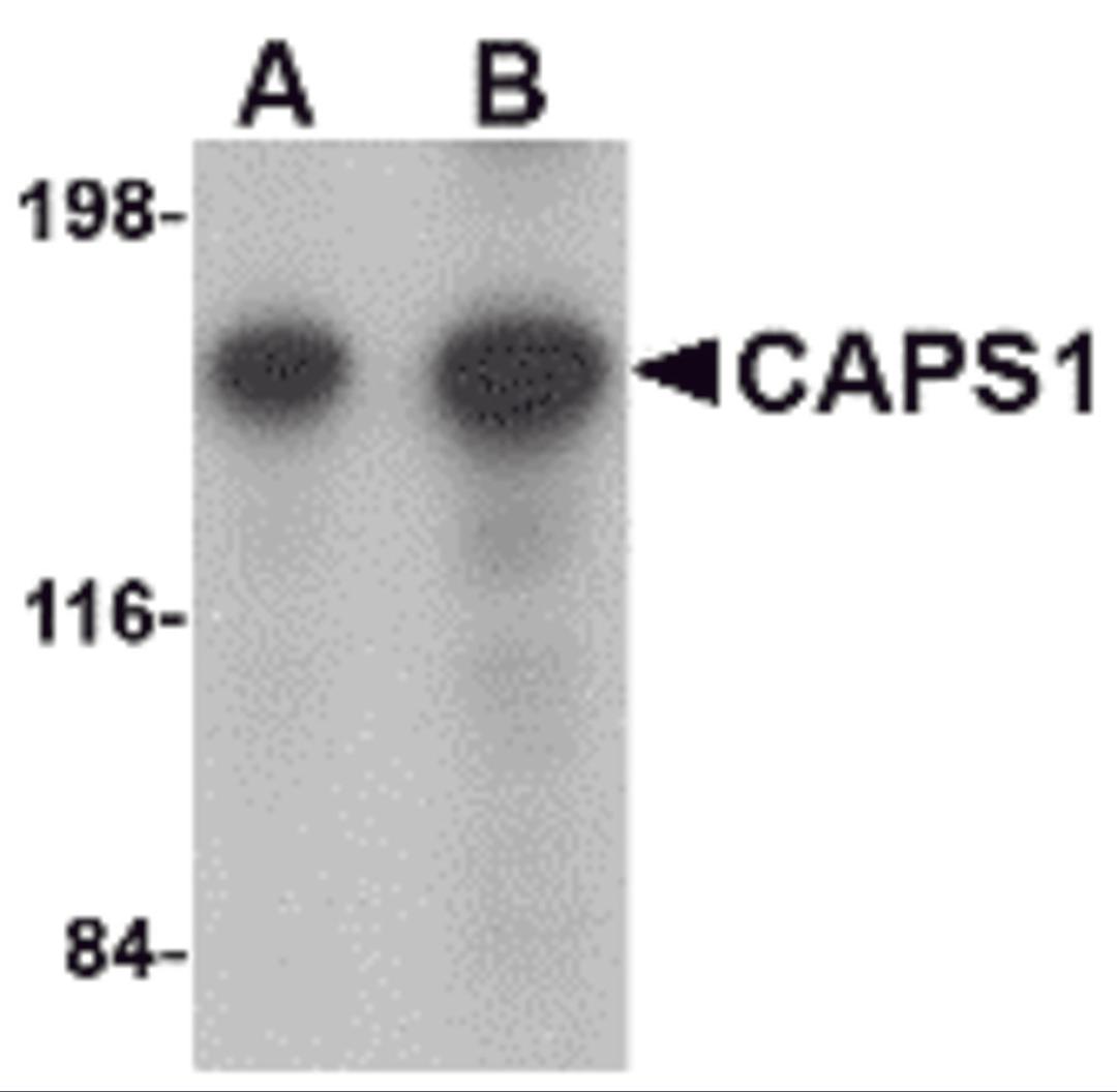 Western blot analysis of CAPS1 in rat brain tissue lysate with CAPS1 antibody at (A) 0.25 and (B) 0.5 μg/mL.
