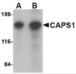 Western blot analysis of CAPS1 in rat brain tissue lysate with CAPS1 antibody at (A) 0.25 and (B) 0.5 μg/mL.