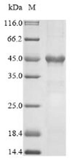 (Tris-Glycine gel) Discontinuous SDS-PAGE (reduced) with 5% enrichment gel and 15% separation gel.