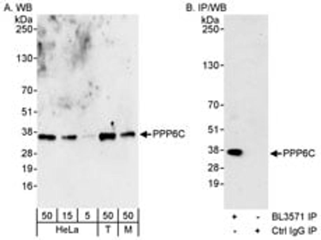 Detection of human and mouse PPP6C by western blot (h&m) and immunoprecipitation (h).