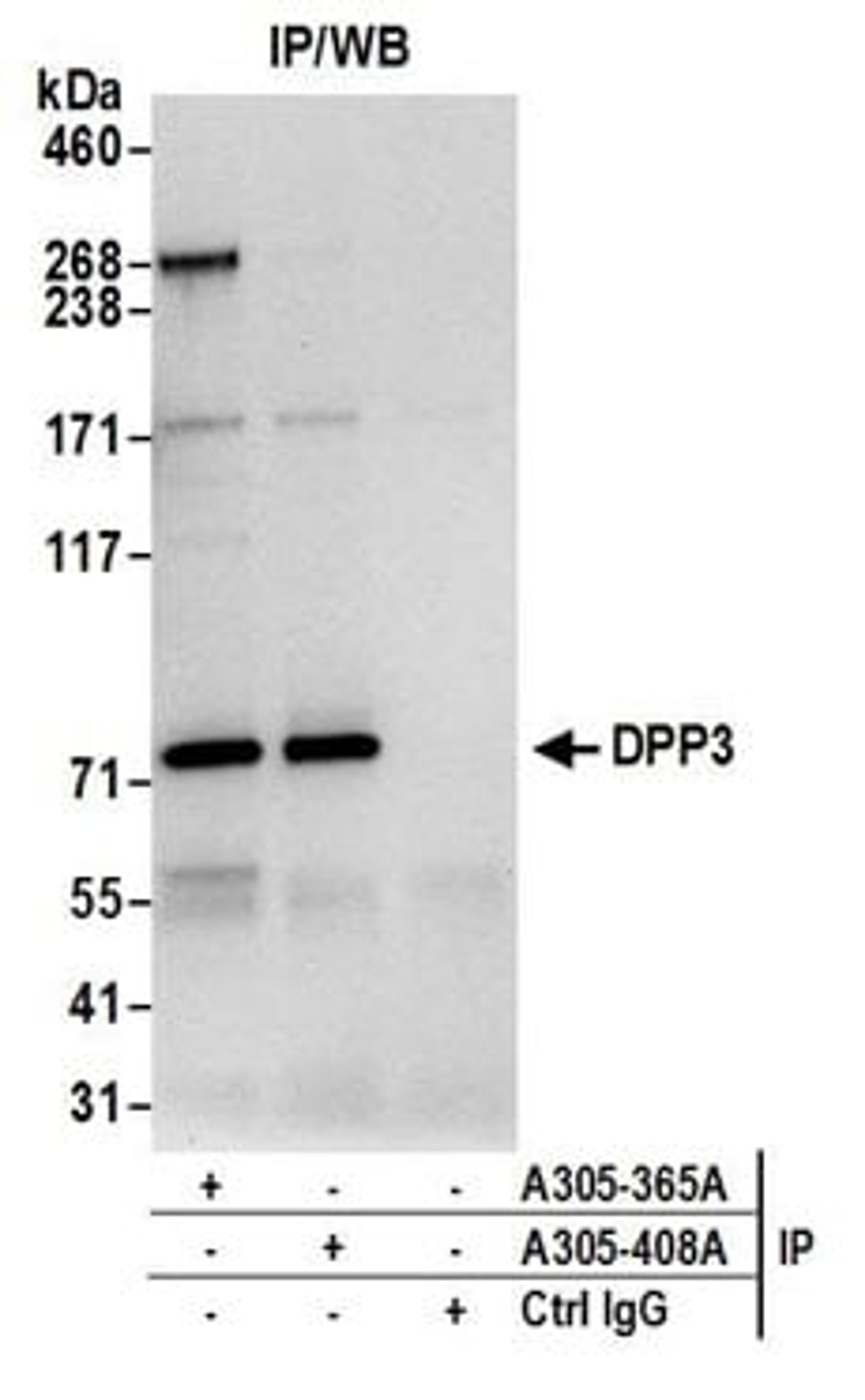 Detection of human DPP3 by western blot of immunoprecipitates.