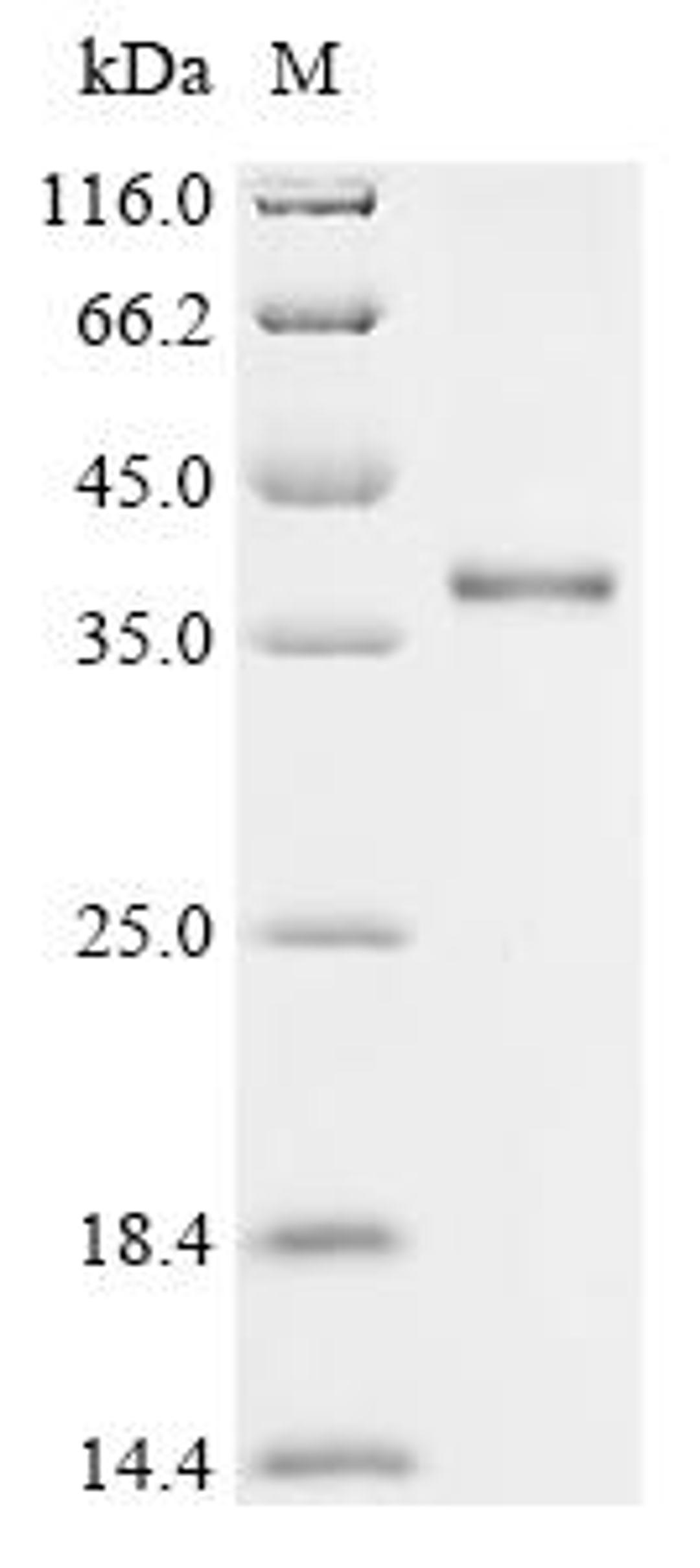 (Tris-Glycine gel) Discontinuous SDS-PAGE (reduced) with 5% enrichment gel and 15% separation gel.