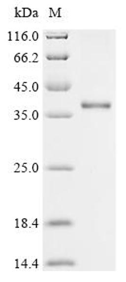(Tris-Glycine gel) Discontinuous SDS-PAGE (reduced) with 5% enrichment gel and 15% separation gel.