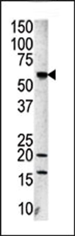 Western blot analysis of anti-Aurora-A Pab in A2058 cell line lysate.