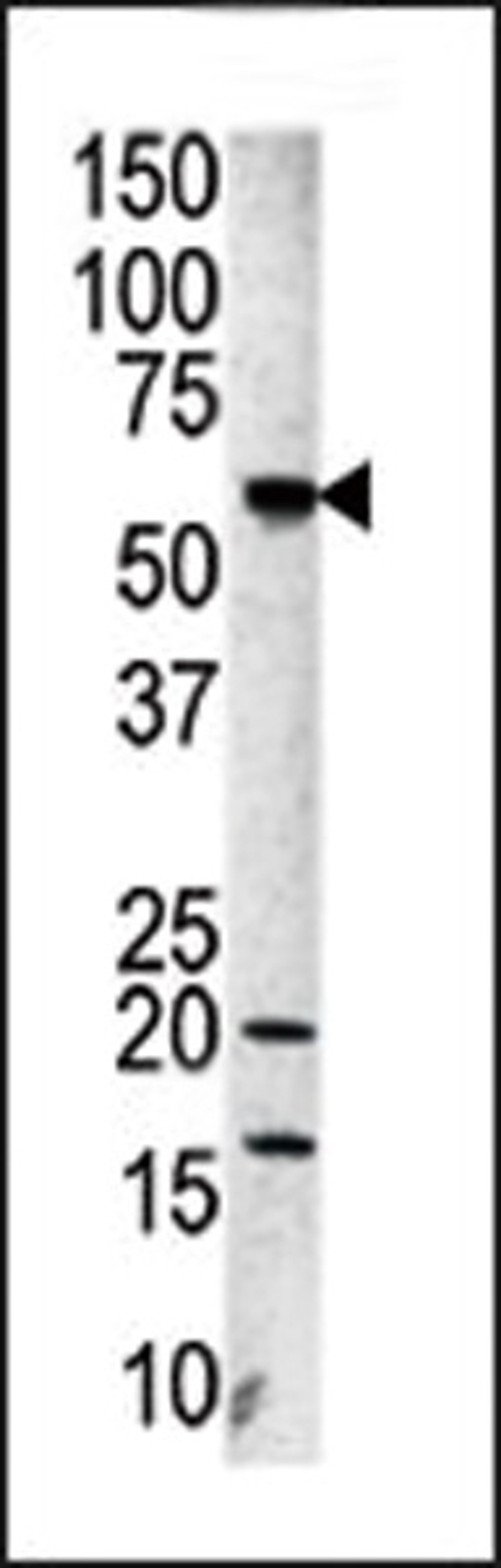 Western blot analysis of anti-Aurora-A Pab in A2058 cell line lysate.