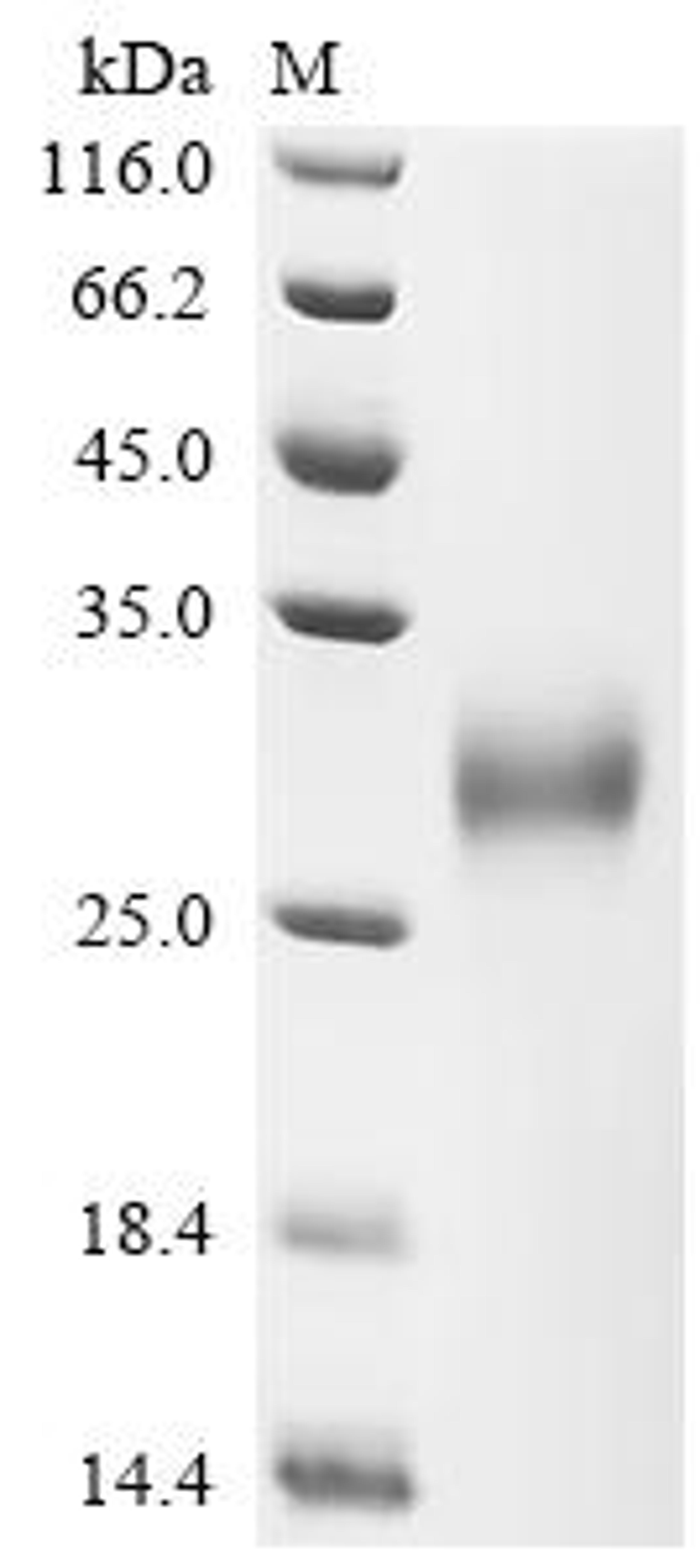 (Tris-Glycine gel) Discontinuous SDS-PAGE (reduced) with 5% enrichment gel and 15% separation gel.