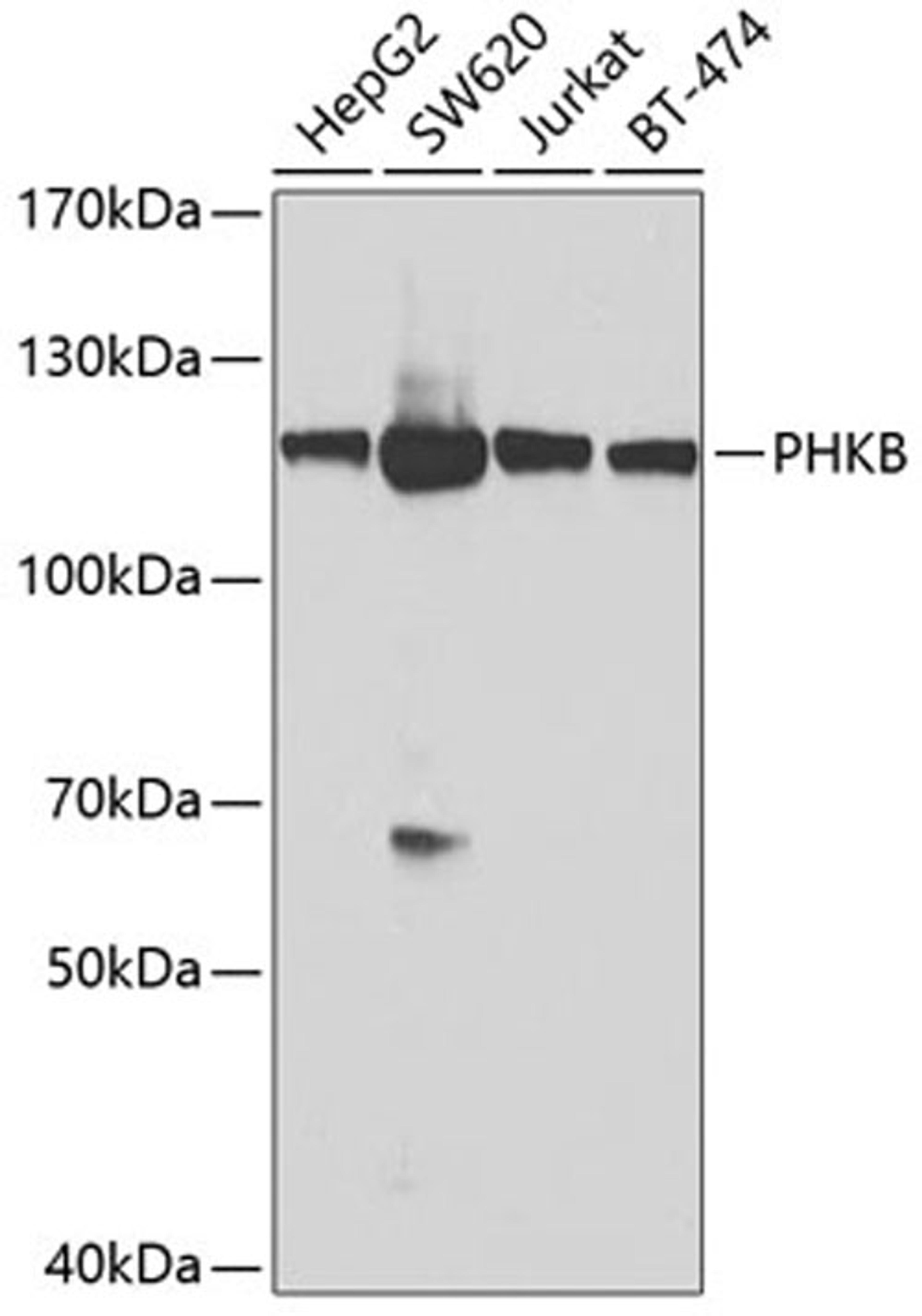 Western blot - PHKB antibody (A8015)