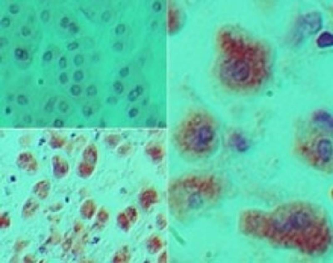 Immunohistochemistry-Paraffin: DACH1 Antibody [NBP2-27192] - Analysis of Dach1 in formalin-fixed, paraffin-embedded human kidney tissue using an isotype control (top left) and this antibody (bottom left, right) at 5 ug/ml.