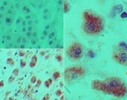 Immunohistochemistry-Paraffin: DACH1 Antibody [NBP2-27192] - Analysis of Dach1 in formalin-fixed, paraffin-embedded human kidney tissue using an isotype control (top left) and this antibody (bottom left, right) at 5 ug/ml.