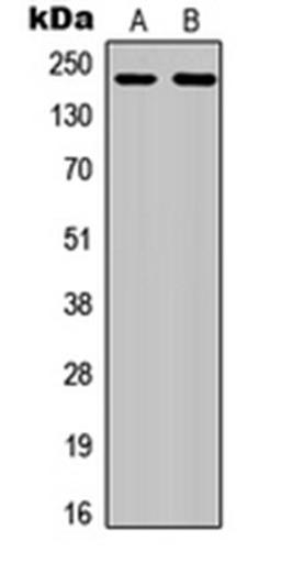 Western blot analysis of HuvEc PMA-treated (Lane1), SHSY5Y (Lane2) whole cell using CD115 (phospho-Y809) antibody