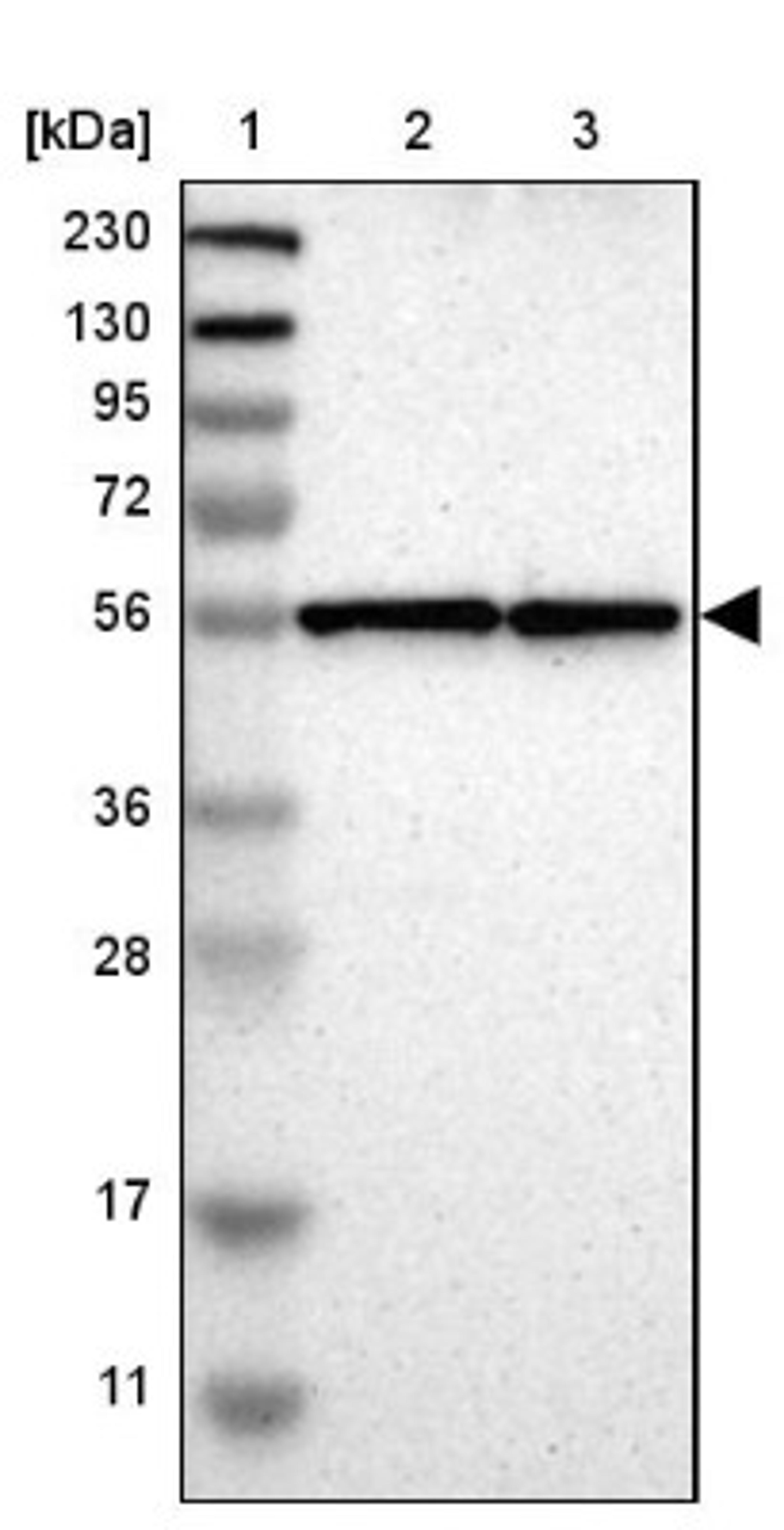 Western Blot: Lunapark Antibody [NBP1-80637] - Lane 1: Marker [kDa] 230, 130, 95, 72, 56, 36, 28, 17, 11<br/>Lane 2: Human cell line RT-4<br/>Lane 3: Human cell line U-251MG sp