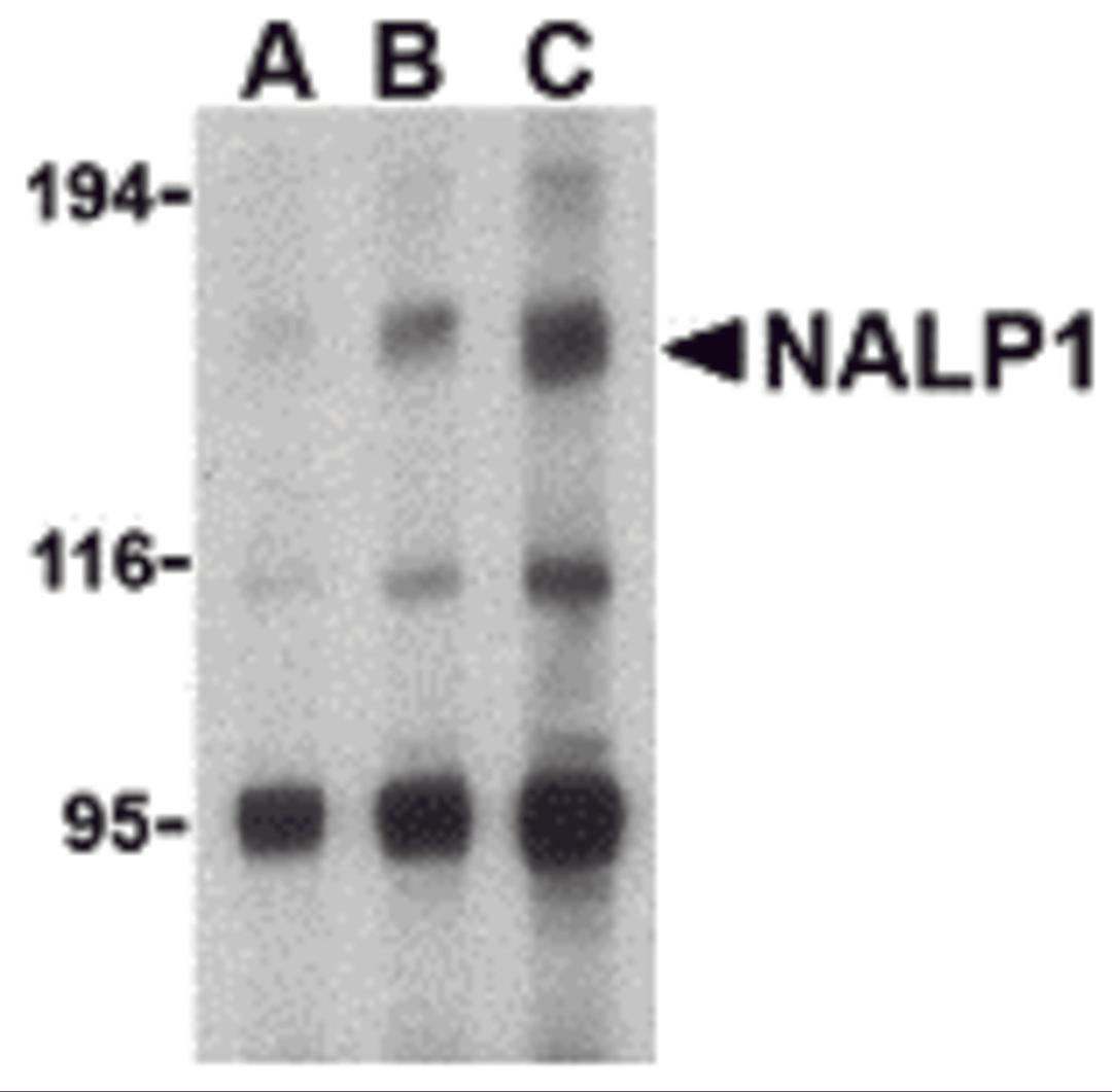 Western blot analysis of NALP1 in U937 cell lysate with NALP1 antibody at (A) 1, (B) 2 and (C) 4 μg/mL.