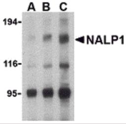 Western blot analysis of NALP1 in U937 cell lysate with NALP1 antibody at (A) 1, (B) 2 and (C) 4 μg/mL.