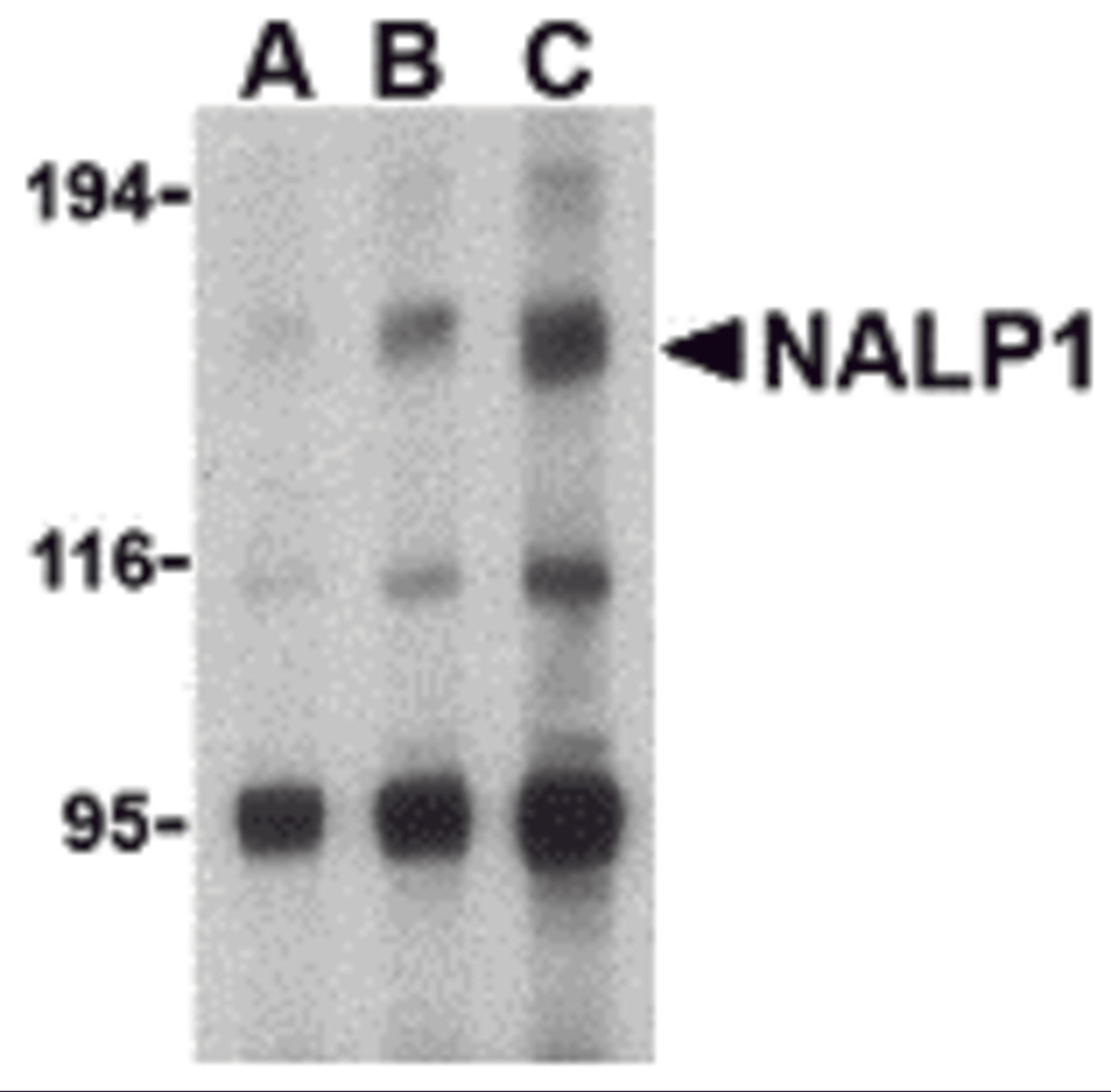 Western blot analysis of NALP1 in U937 cell lysate with NALP1 antibody at (A) 1, (B) 2 and (C) 4 μg/mL.