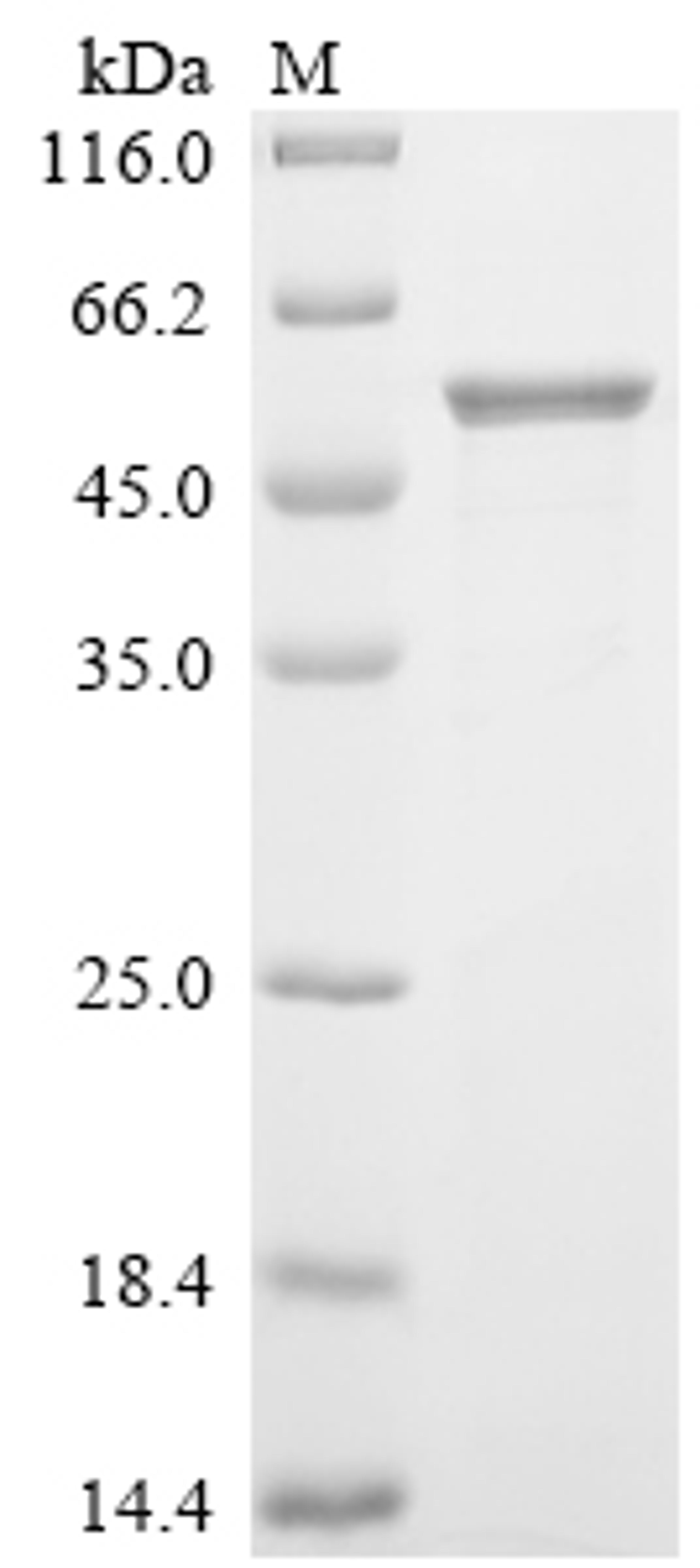 (Tris-Glycine gel) Discontinuous SDS-PAGE (reduced) with 5% enrichment gel and 15% separation gel.
