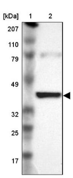 Western Blot: IDH3G Antibody [NBP1-85810] - Lane 1: Marker [kDa] 207, 110, 79, 49, 32, 25, 17<br/>Lane 2: Human cell line RT-4