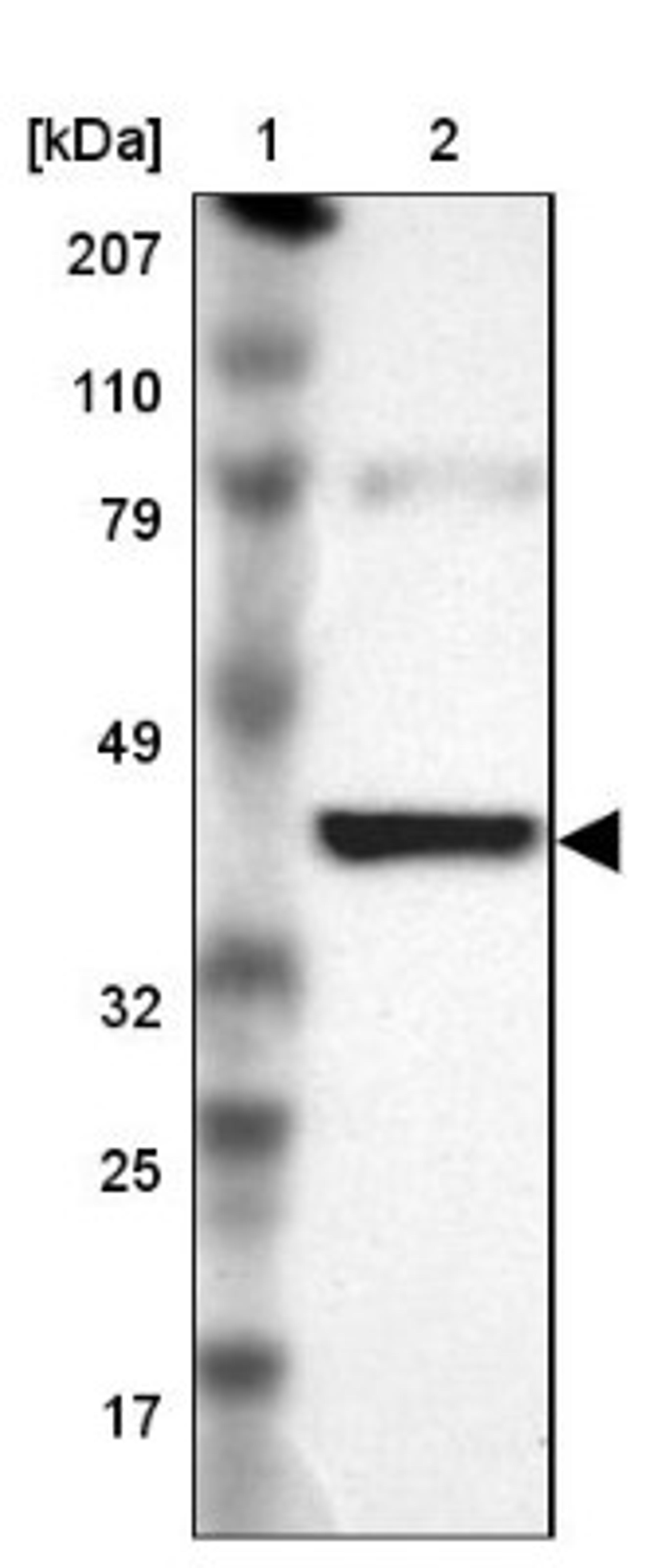 Western Blot: IDH3G Antibody [NBP1-85810] - Lane 1: Marker [kDa] 207, 110, 79, 49, 32, 25, 17<br/>Lane 2: Human cell line RT-4