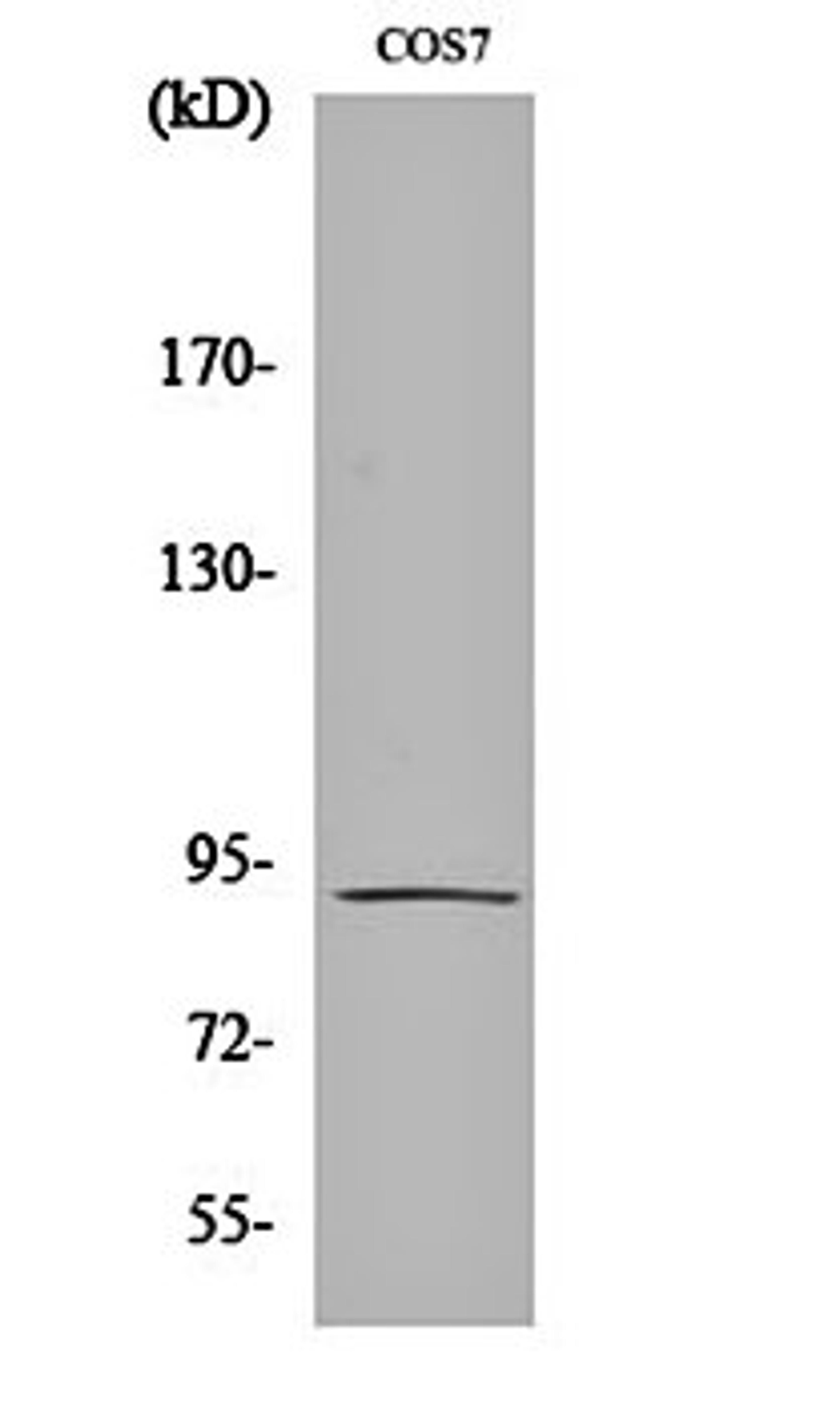 Western blot analysis of COS7 cell lysates using Integrin beta 5 antibody