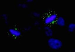 Detection of human Aurora A by immunocytochemistry.