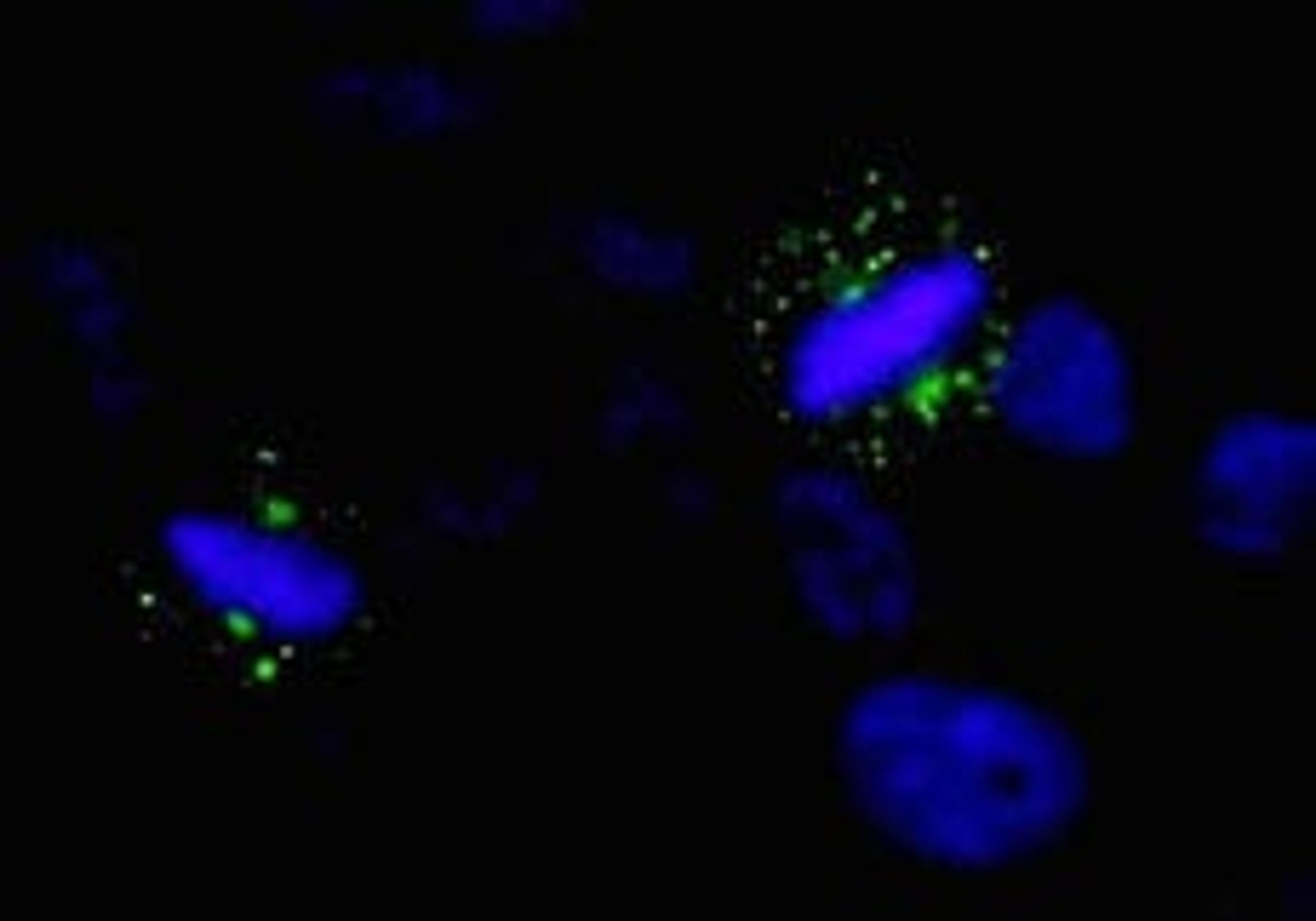 Detection of human Aurora A by immunocytochemistry.